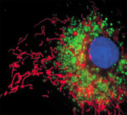 Live Cell Labeling Lysosomes